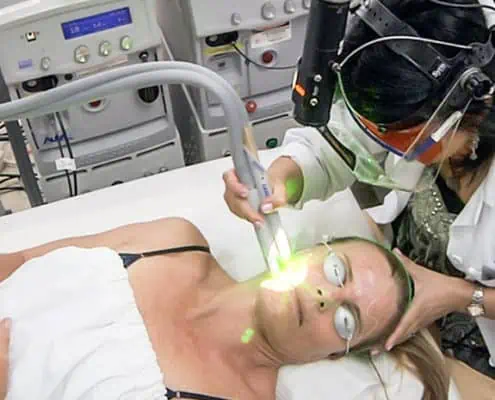 a facelift without surgery