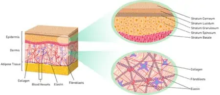 Strengthening the skin’s collagen matrix is how to tighten skin with laser skin tightening.