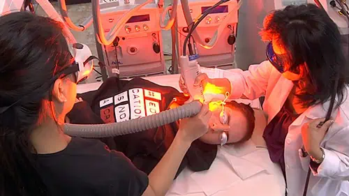 Dr. Alice Pien using one of the many lasers used to reduce and even eliminate the appearance of acne scars.