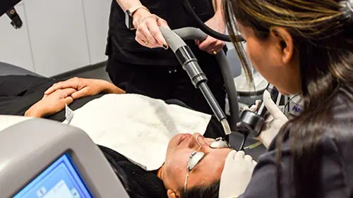 The CO2 Frational laser is one of the lasers we use that is very effective at reducing the appearance of acne scars.