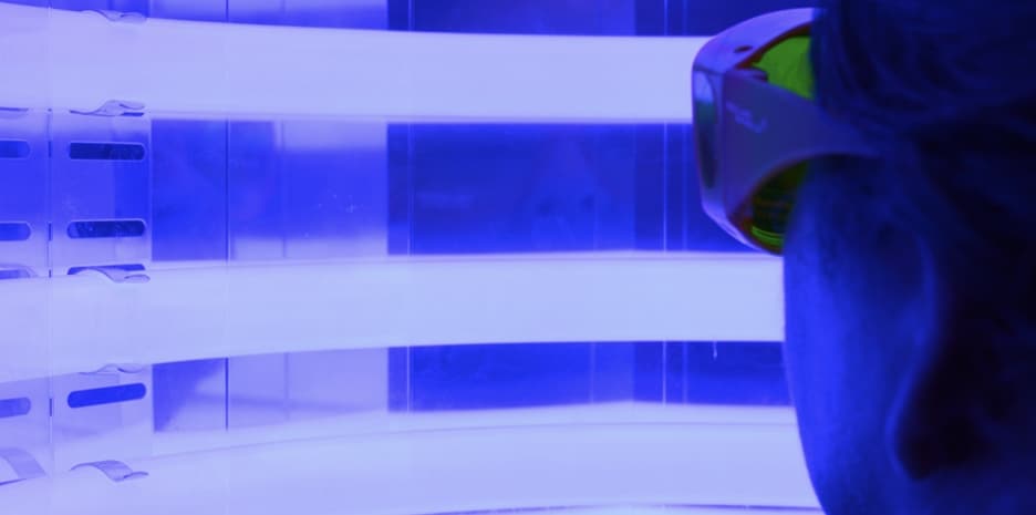 Acne Treatment with Lasers & Photodynamic Therapy (PDT)